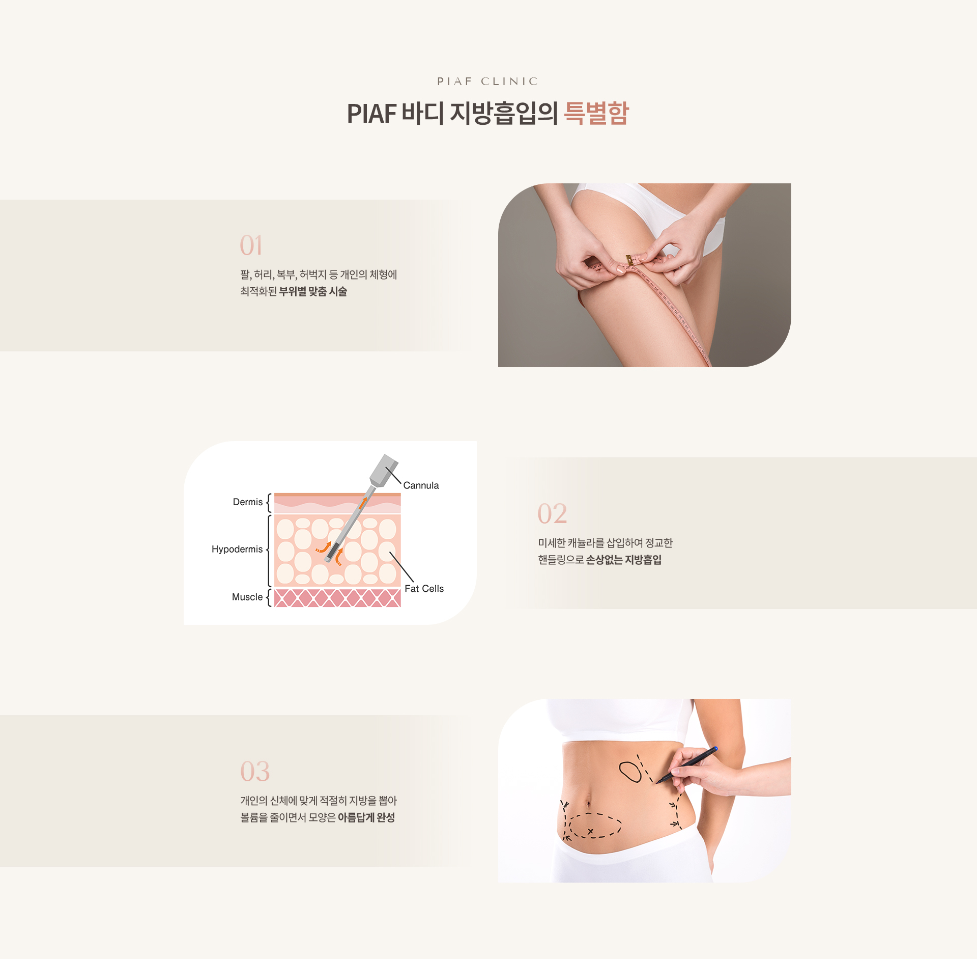 지방성형 상세03