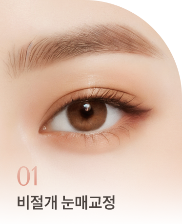 눈매교정 상세01 리스트1