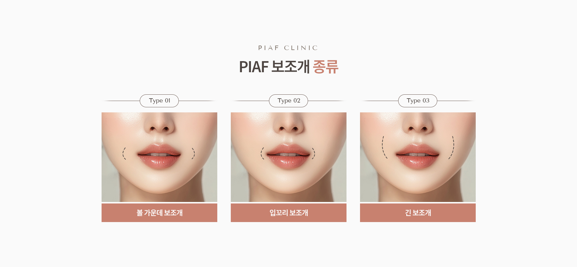 보조개 상세02