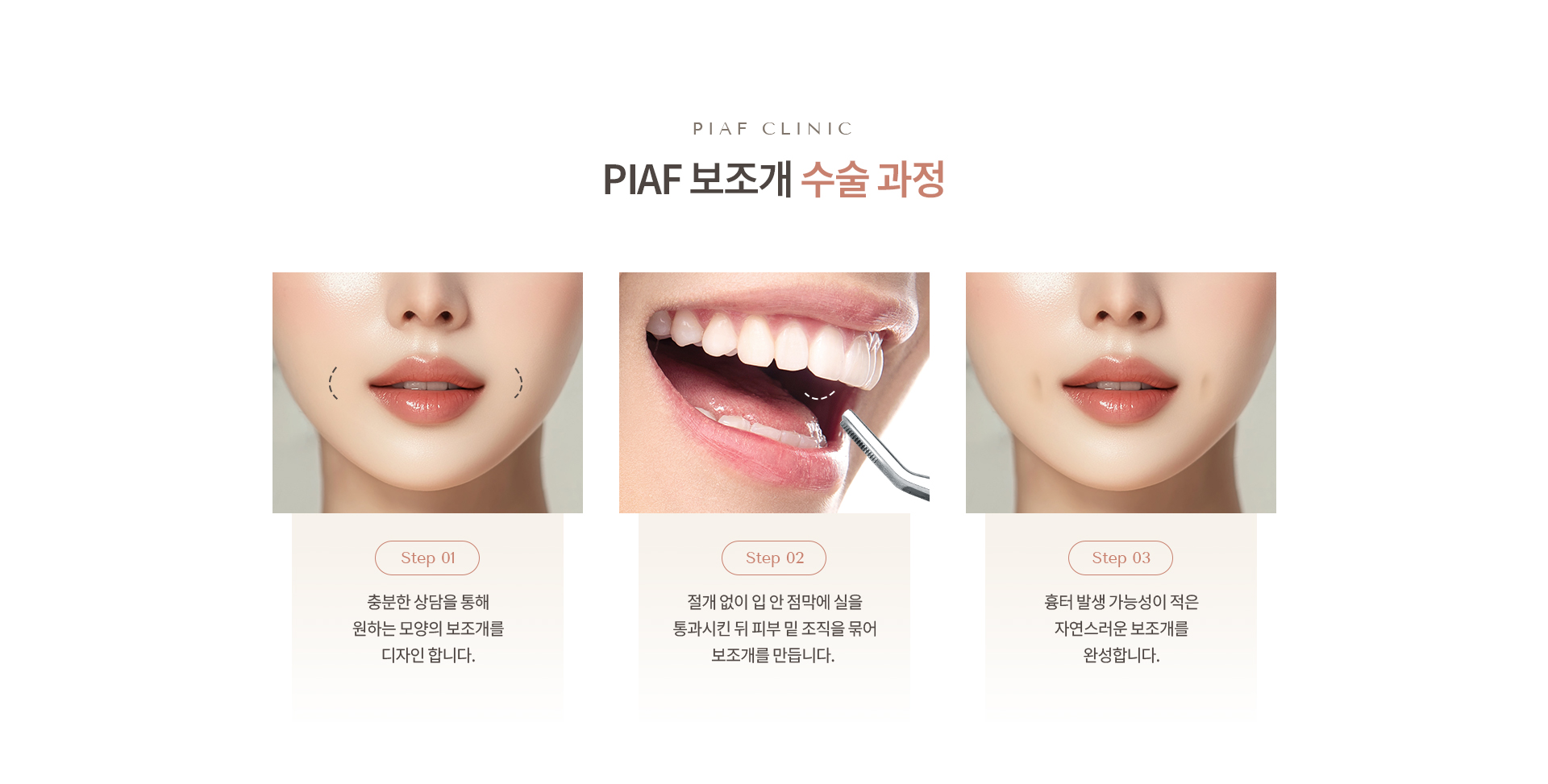 보조개 상세04