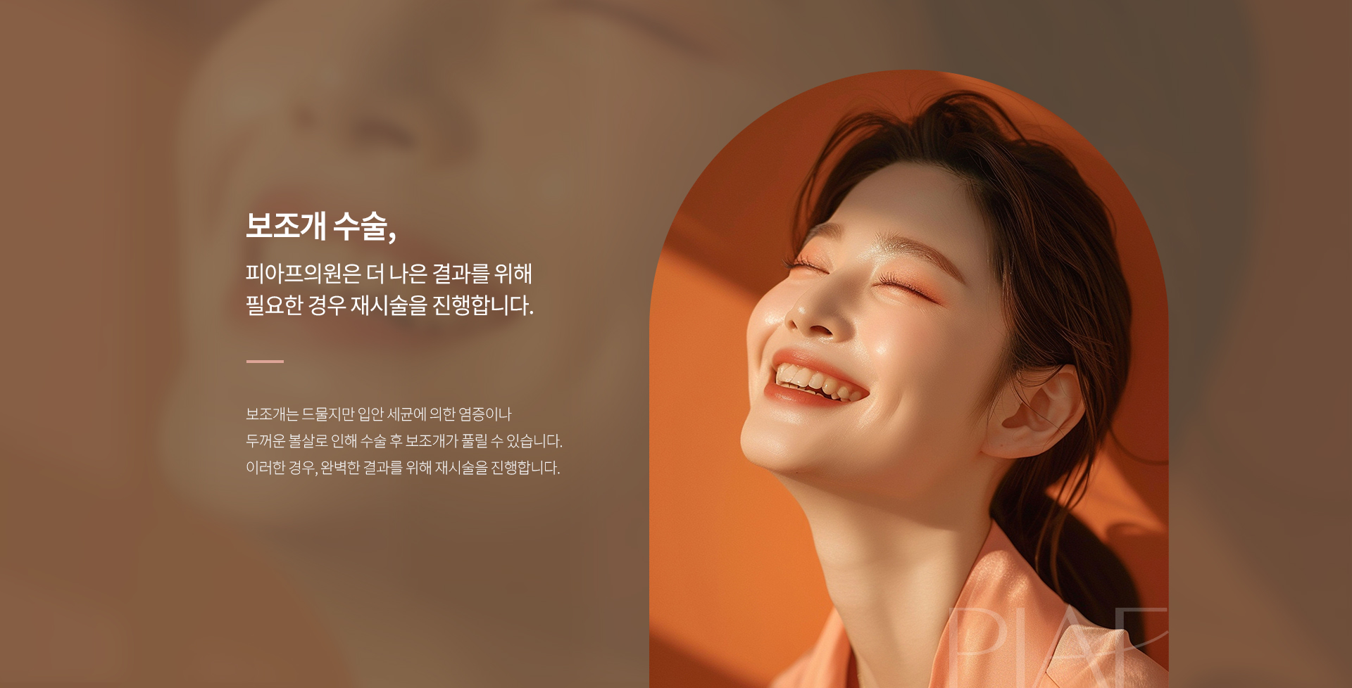 보조개 상세06