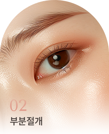 쌍꺼풀 상세01 리스트2