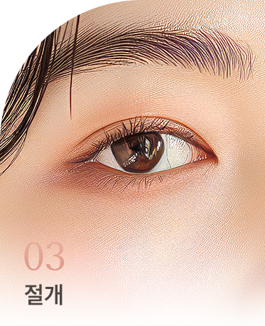 쌍꺼풀 상세01 리스트3