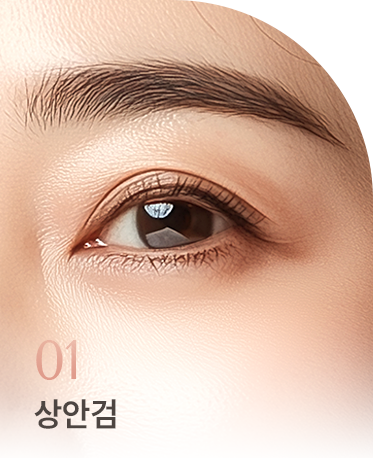 중년 눈성형 상세01 리스트1