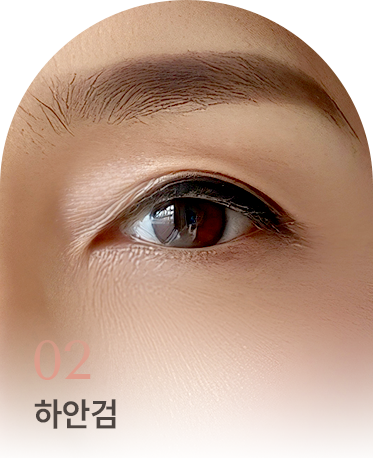 중년 눈성형 상세01 리스트2