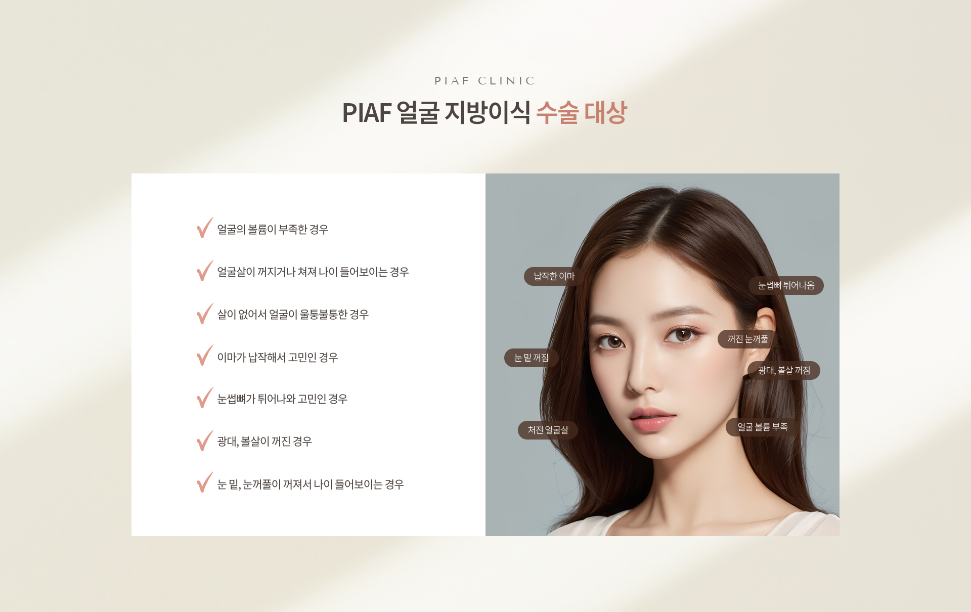 얼굴 지방이식 상세07
