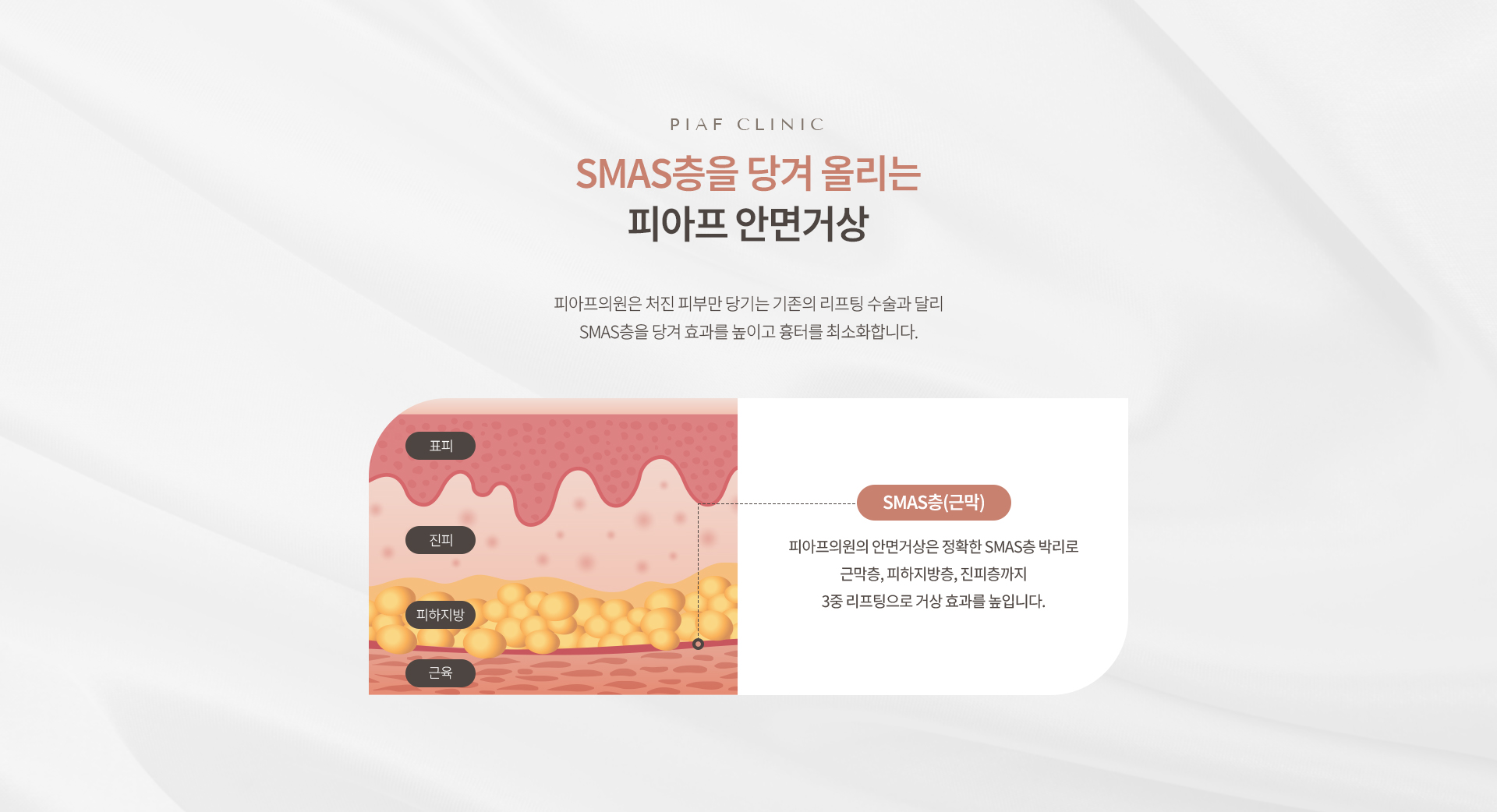 안면거상 상세03