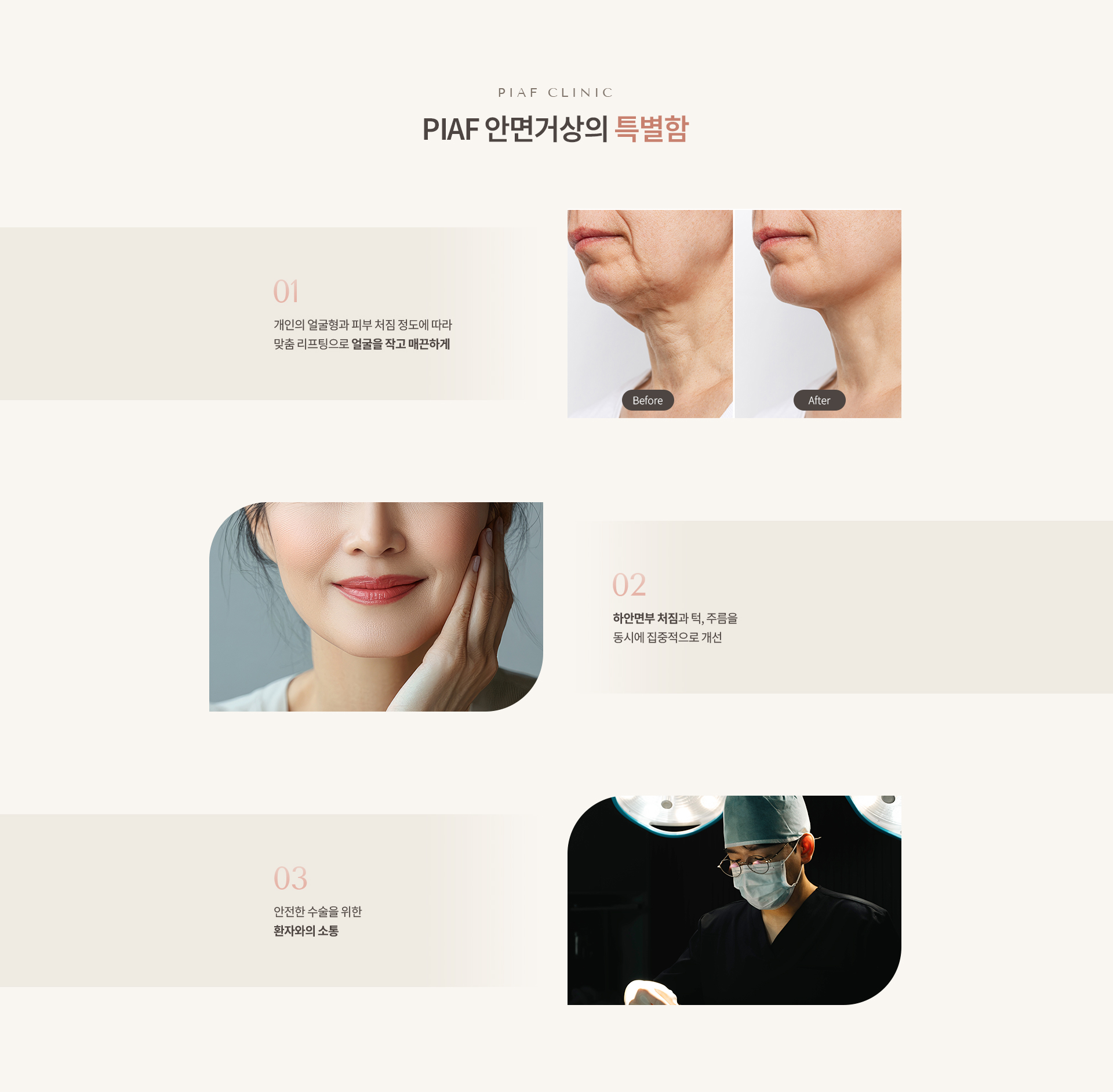 안면거상 상세04