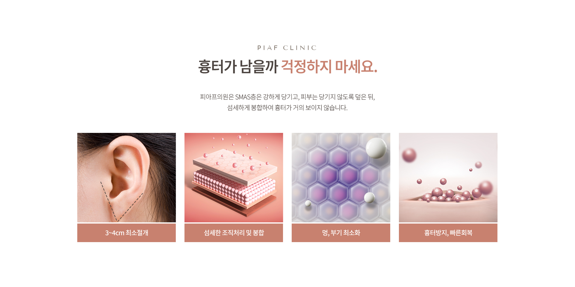 안면거상 상세05