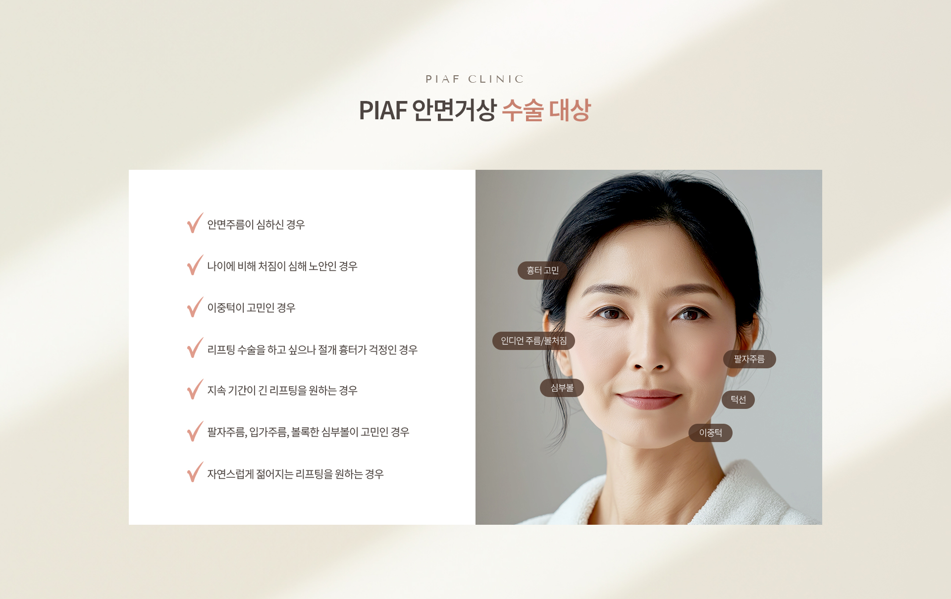 안면거상 상세07