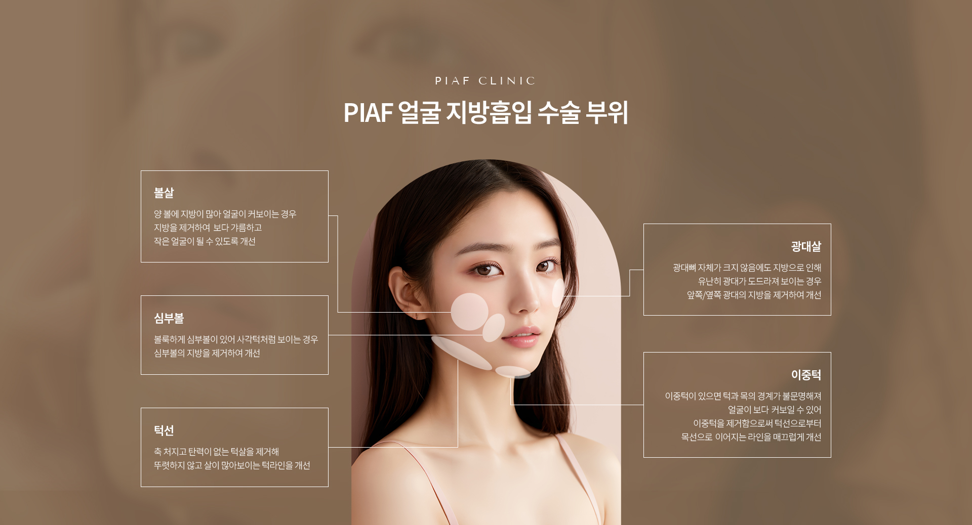 얼굴 지방흡입 상세03