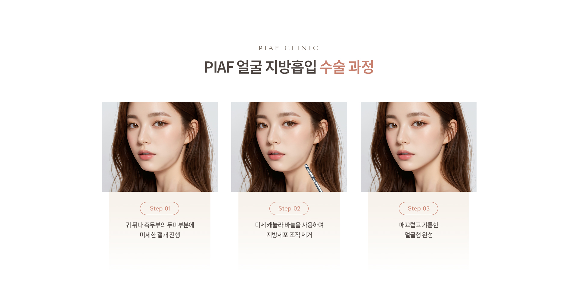 얼굴 지방흡입 상세05