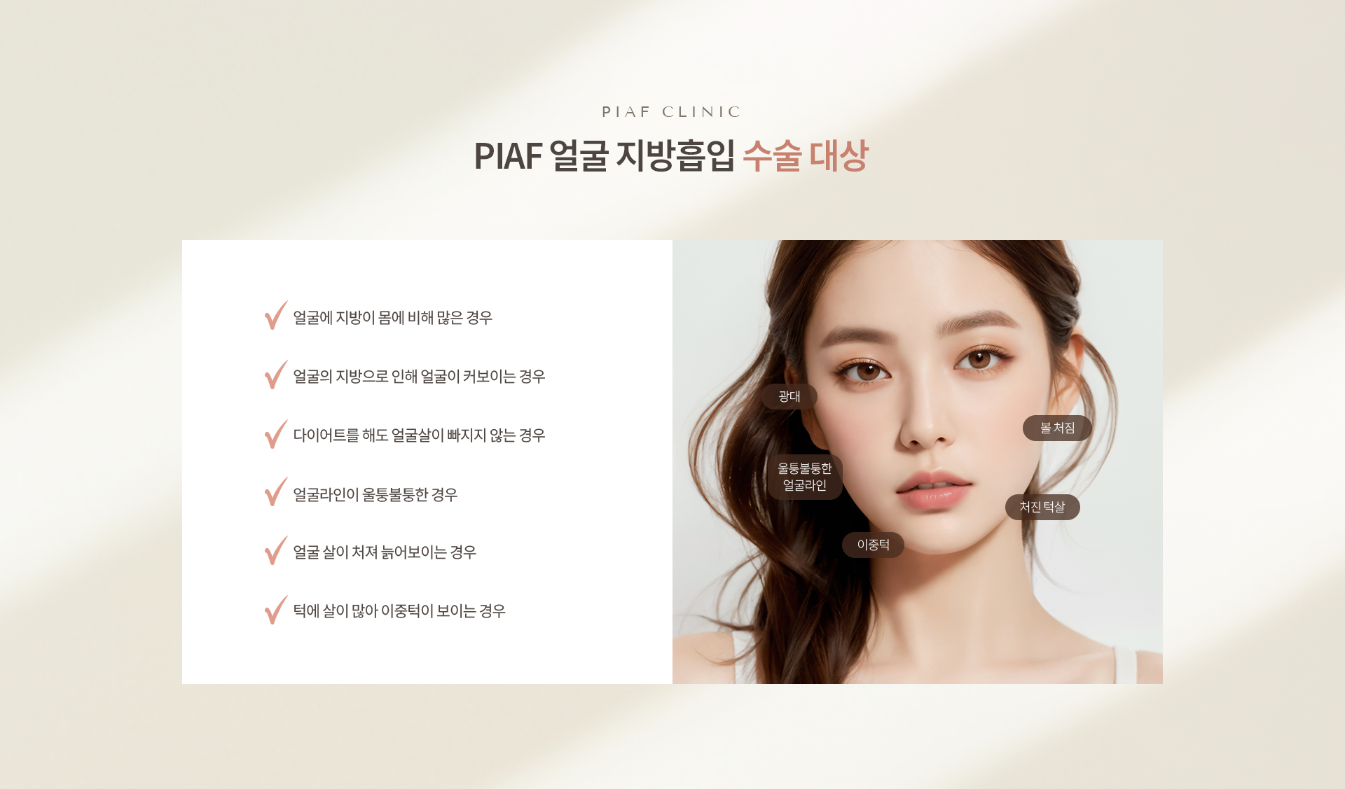 얼굴 지방흡입 상세07