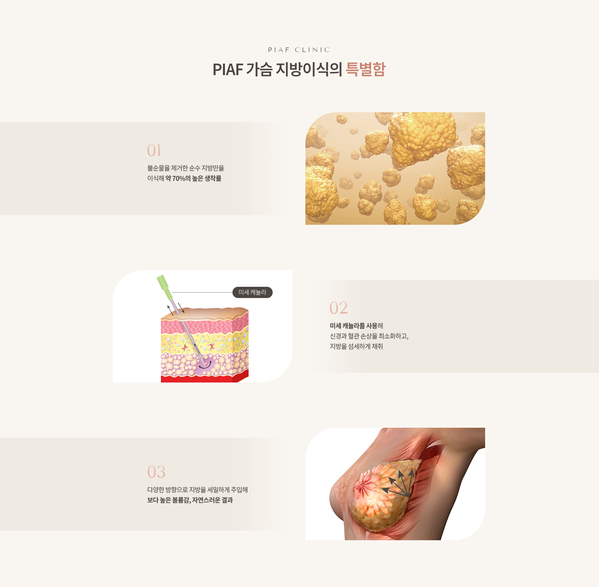 자가지방이식 상세03