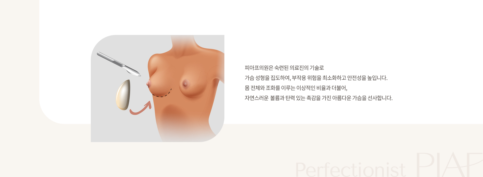 보형물 수술 상세01