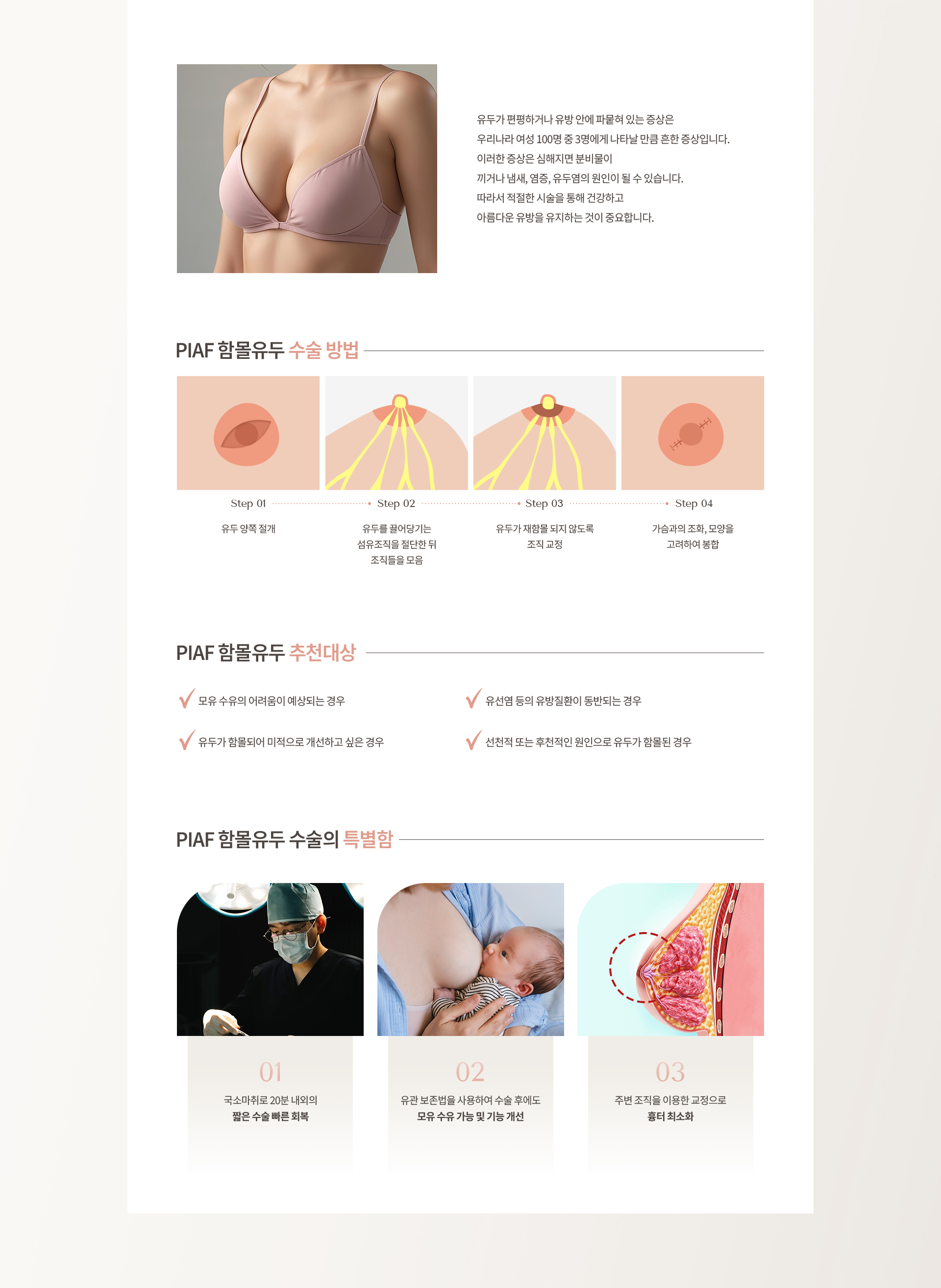 유두성형 상세03