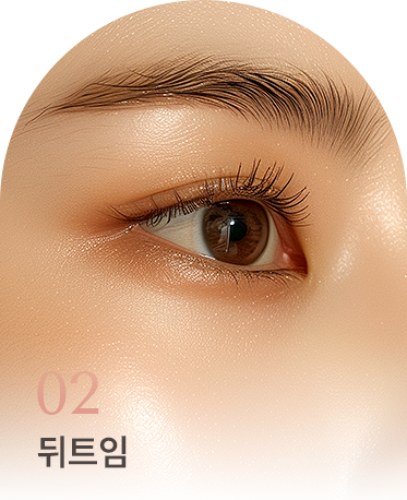 트임 상세01 리스트2