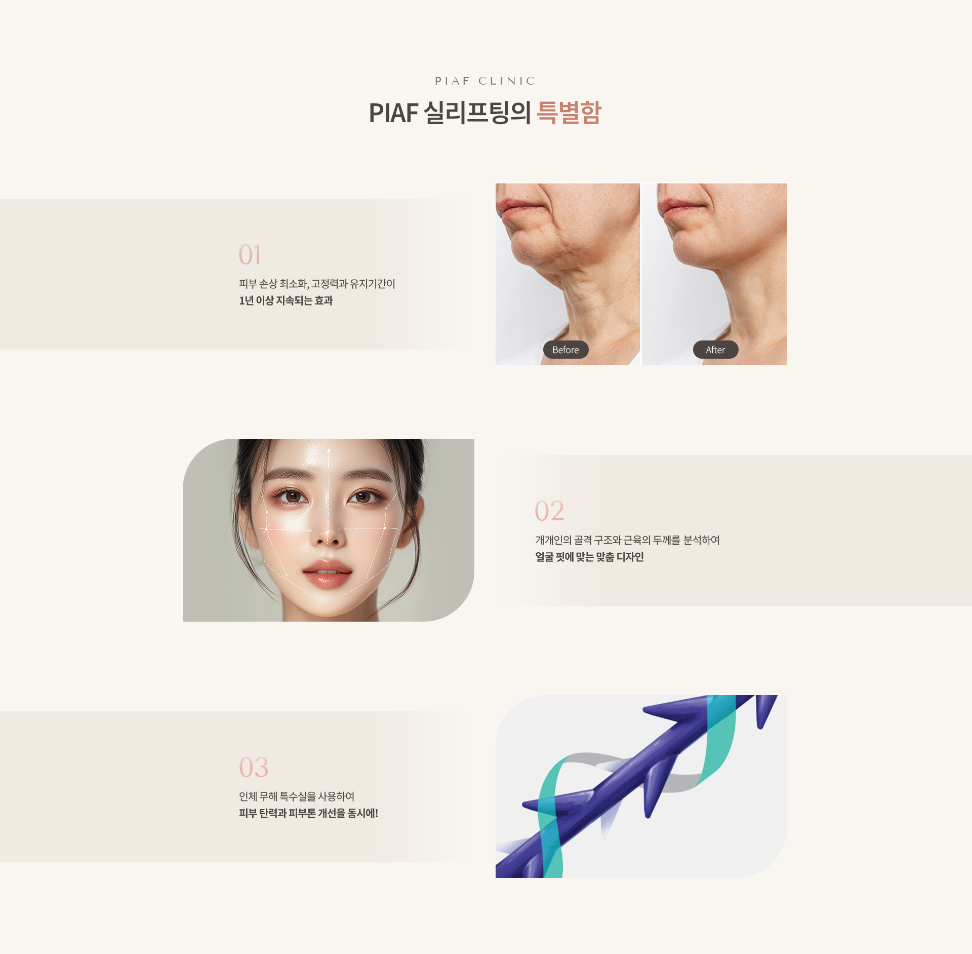 실리프팅 상세04